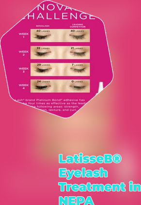 Eyelash fillers