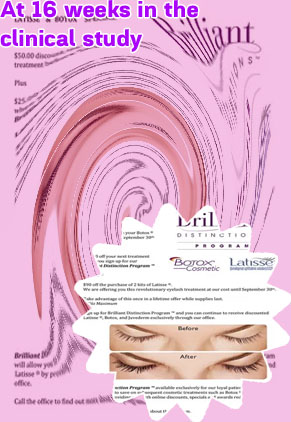 Latisse over the counter