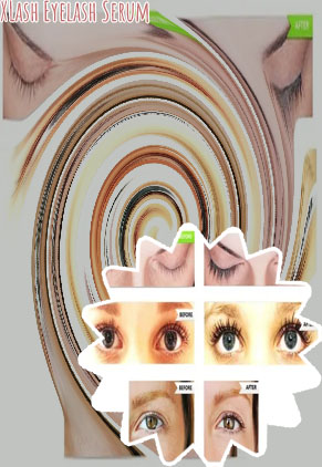 Xlash before and after